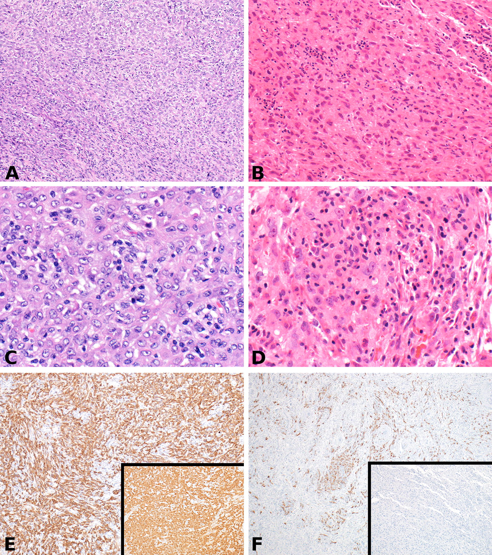 Fig. 2