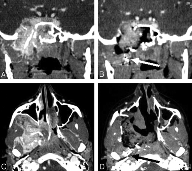 Fig 3.