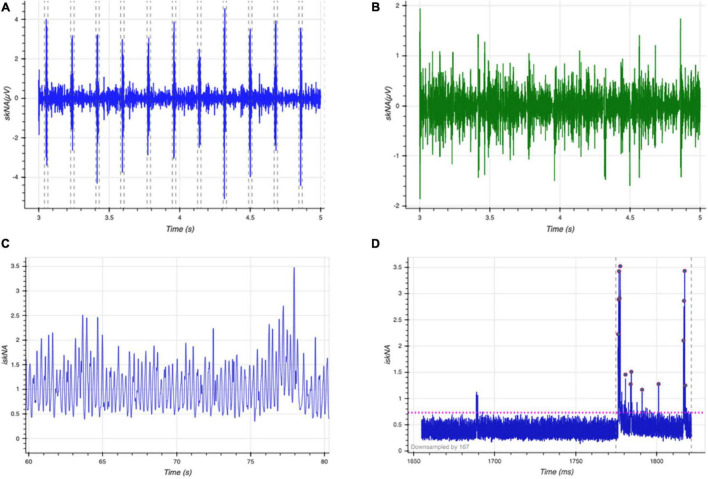 FIGURE 3