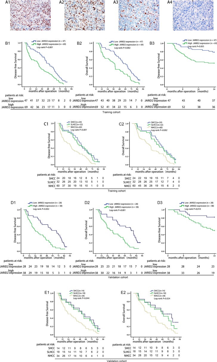 JARID2 promotes invasion and metastasis of hepatocellular carcinoma by ...