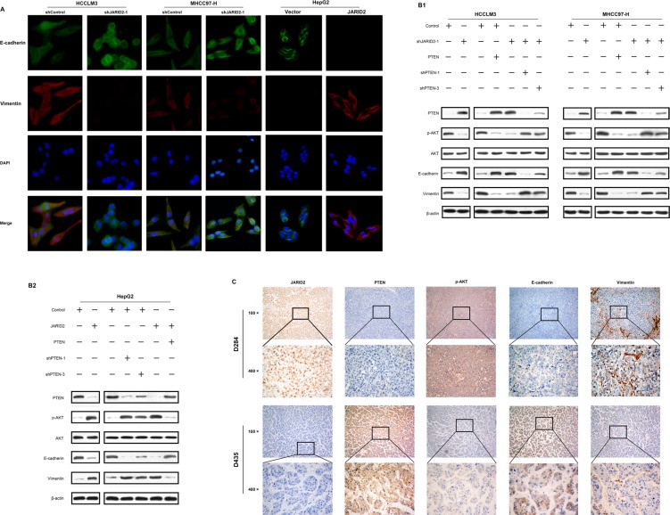 JARID2 promotes invasion and metastasis of hepatocellular carcinoma by ...