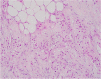 Fig. 11