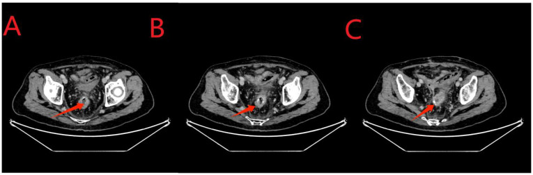 Figure 7