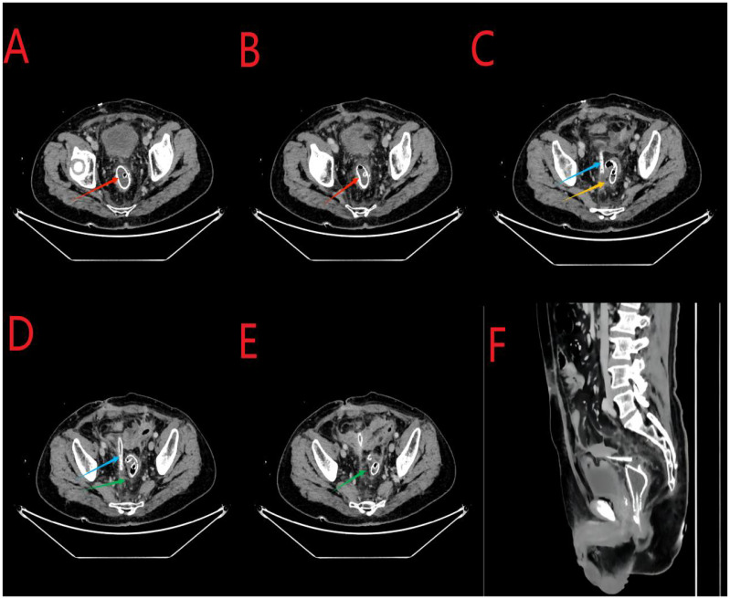 Figure 3