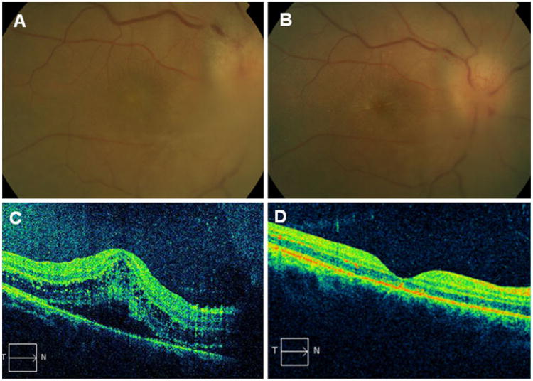 Fig. 1