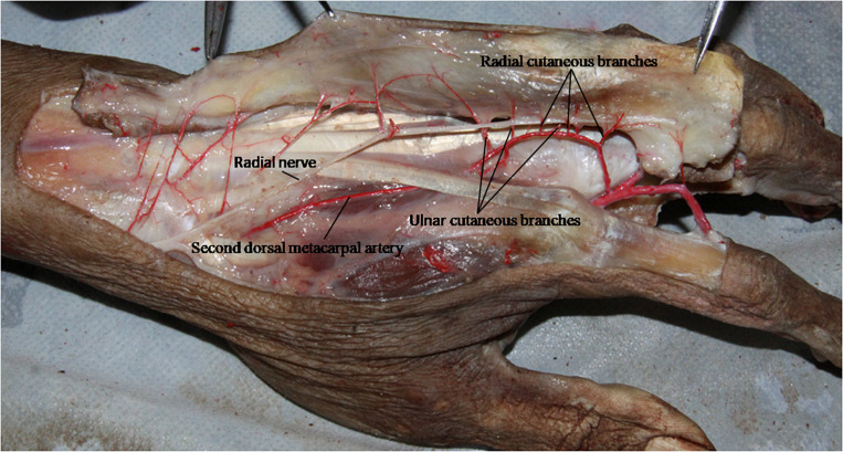 FIGURE 3