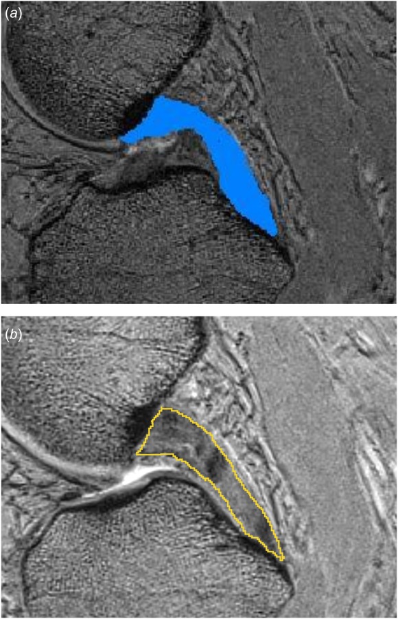 Fig. 5