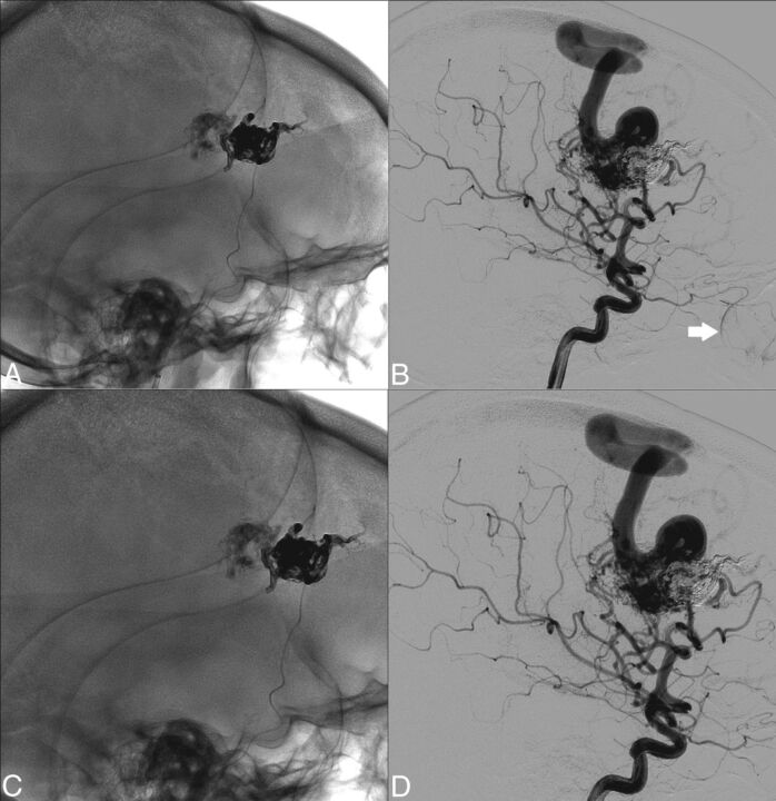 Fig 4.