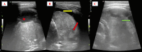 Fig 4