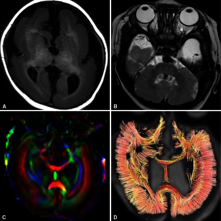 Fig. 1