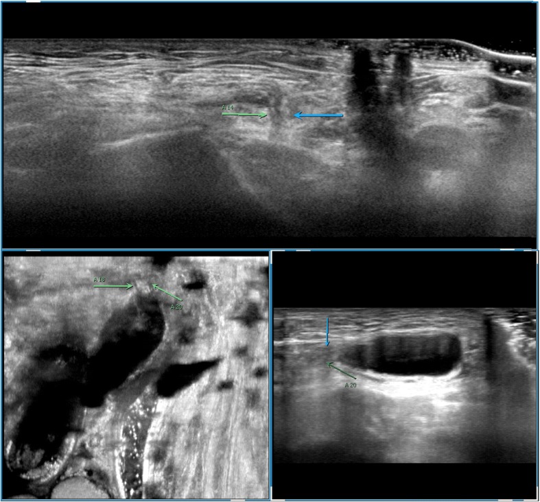 Fig. 6