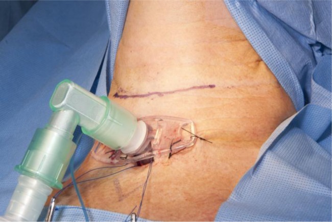 Figure 1: