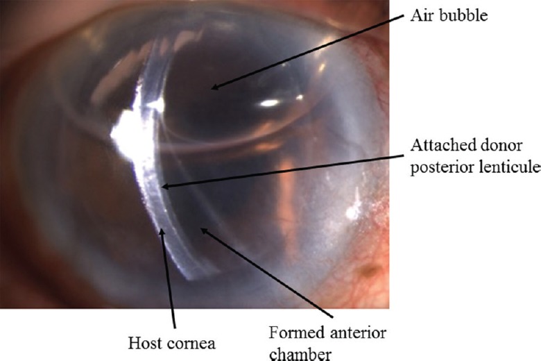 Fig. 11