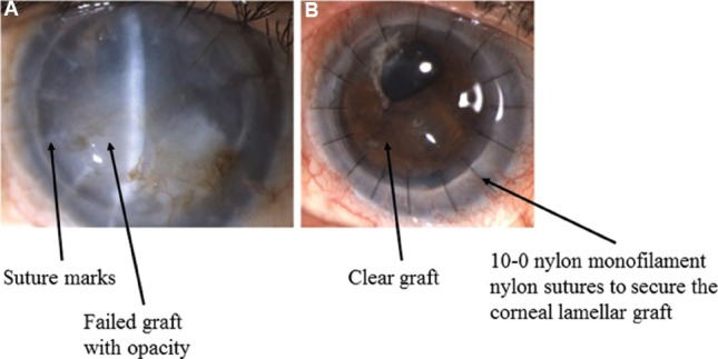 Fig. 12