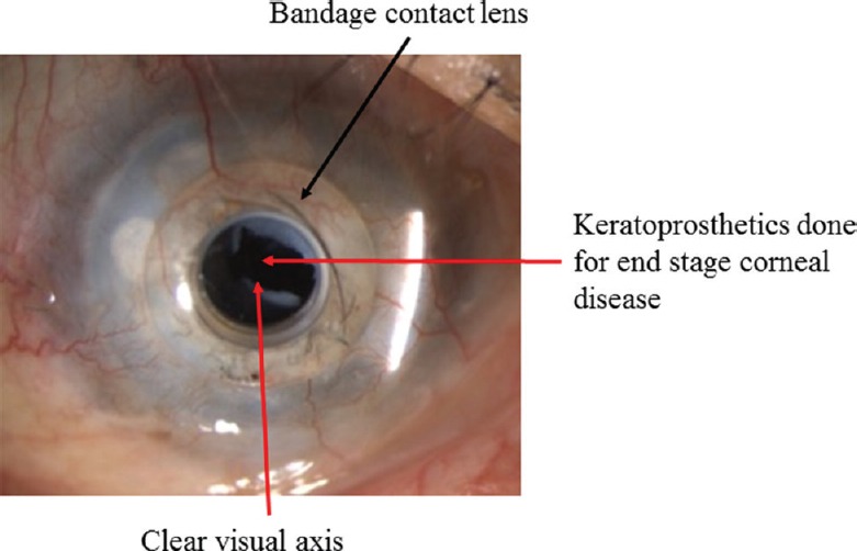 Fig. 15