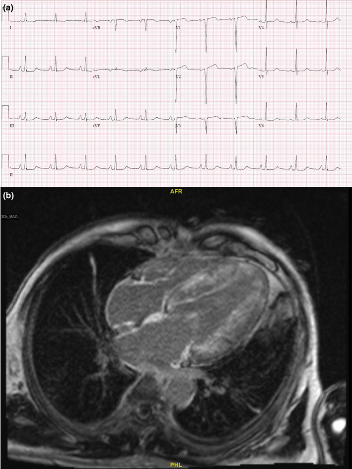 FIGURE 3