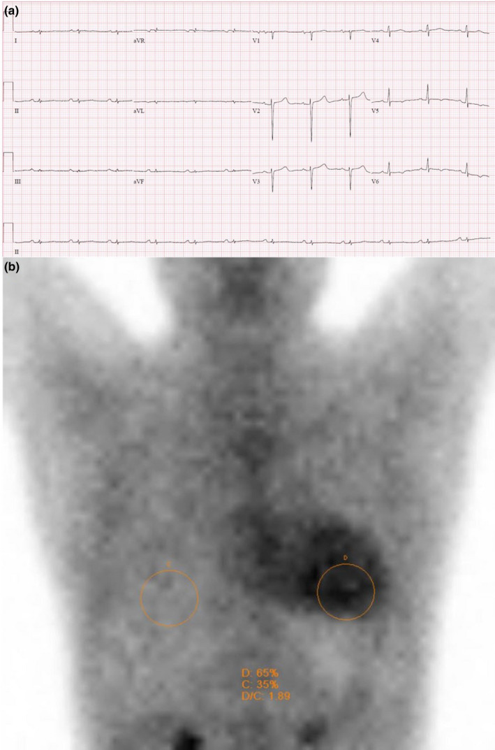 FIGURE 1