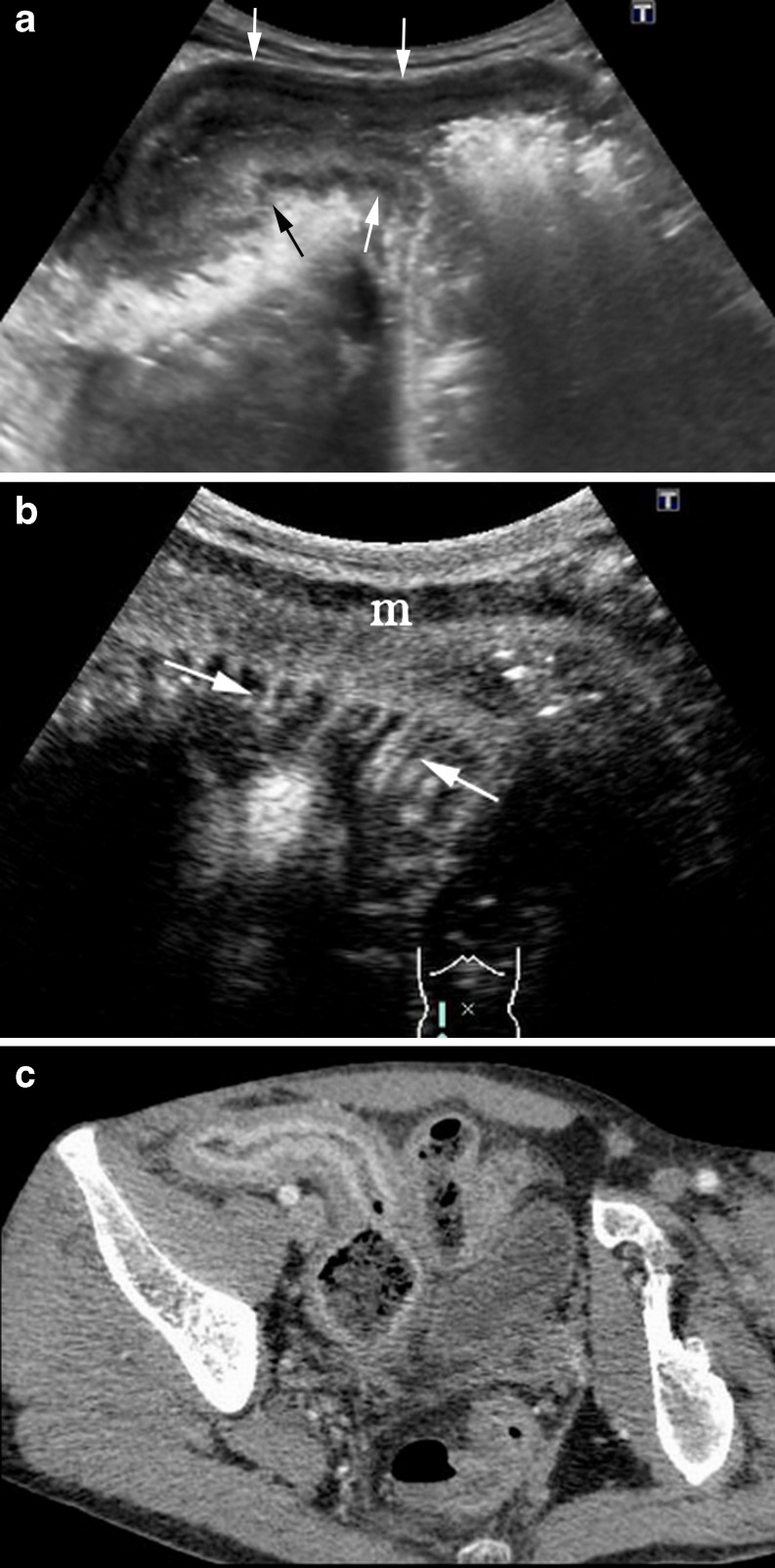 Fig. 15