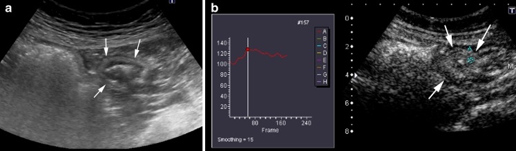 Fig. 10