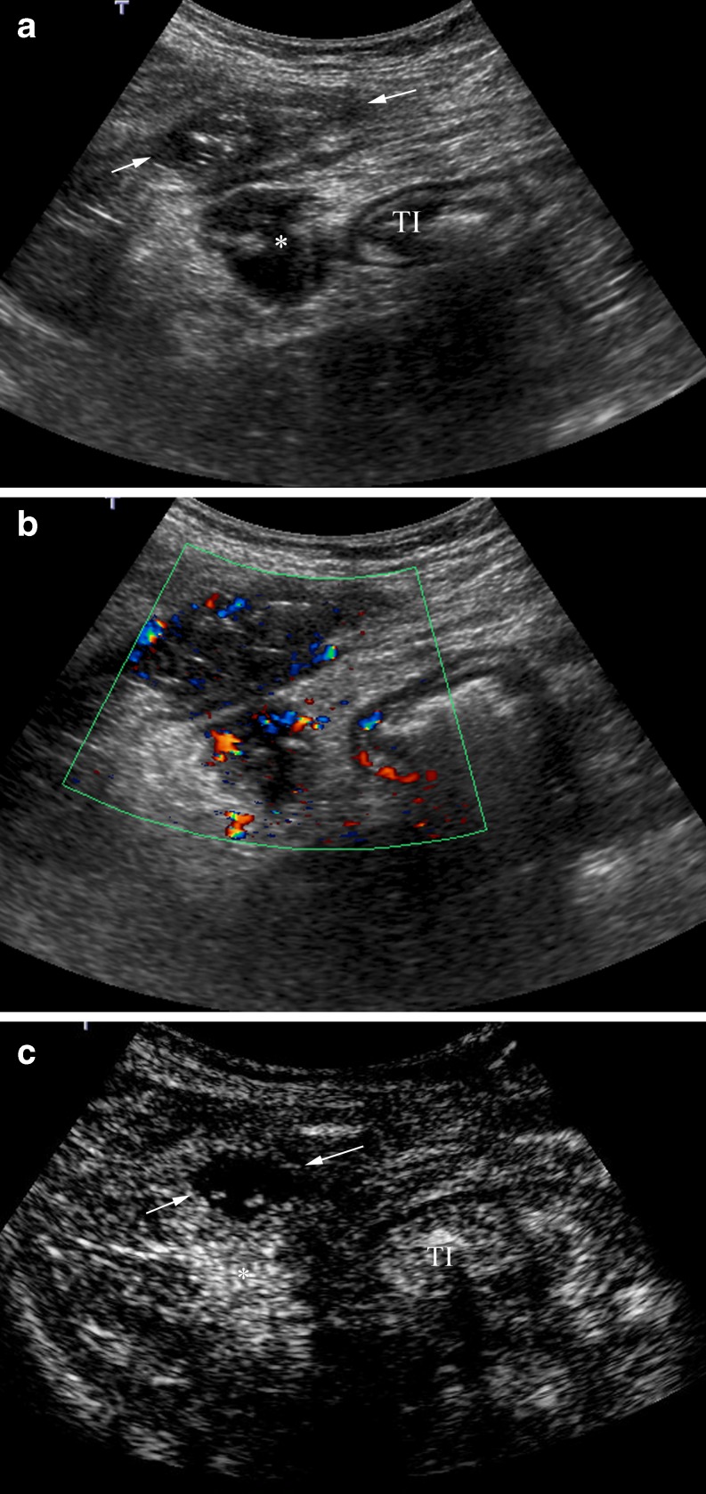 Fig. 12