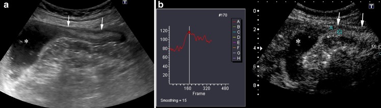 Fig. 13