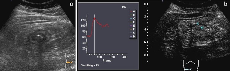 Fig. 17