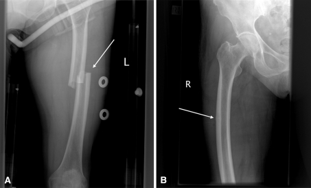 Fig. 3A–B