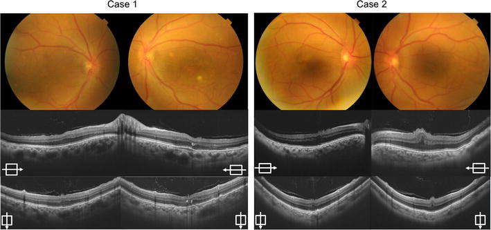 Fig. 1