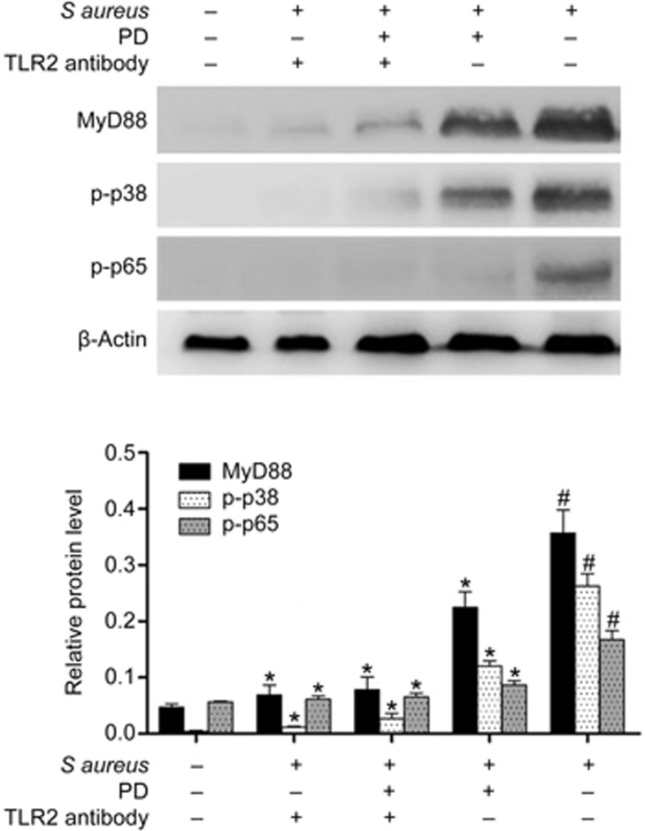 Figure 11