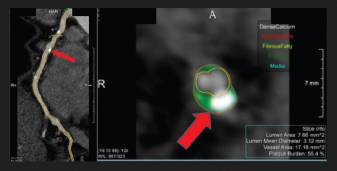 Figure 1: