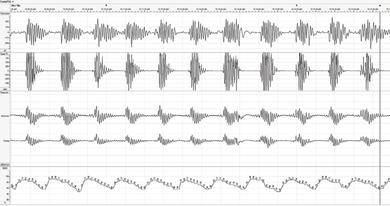 Figure 1: