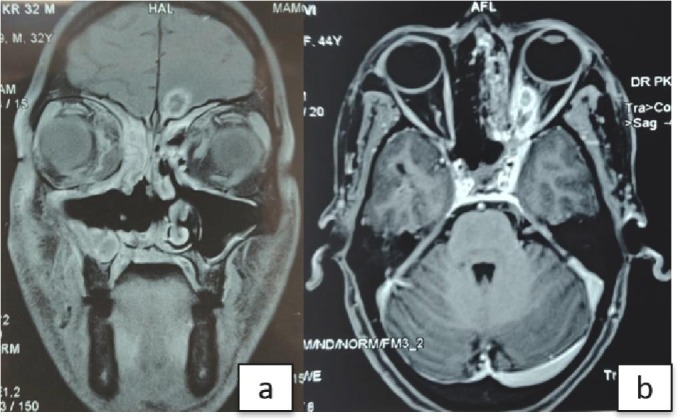 Fig. 5