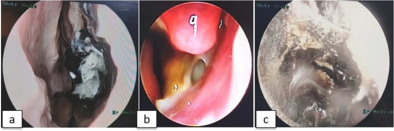 Fig. 8