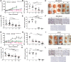 Figure 2. Triple combination therapy reduces HR+/HER2+ tumor growth in vivo. MDA-MB-361 xenografts (N = 10–12 tumors per group) and BT474 xenografts (N = 9–12 tumors per group) were treated with vehicle (V), tucatinib (T) or combinations of tucatinib, fulvestrant (F), and palbociclib (P). Results shown for MDA-MB-361 xenografts: A, Tumor growth curves; B, Tumor volumes at end of treatment (EOT); C, Representative tumors at study completion (scale bar, 5 mm); D, Tumor growth rates (TGR; change in tumor volume over time) for each treatment group; (E) Ki67 analysis and (F) Images of representative Ki67 staining (scale bar, 25 μm). Results of BT474 xenografts are shown: G, Tumor growth curves; H, BT474 tumor volumes at EOT; I, Representative tumors from each treatment group at study completion (scale bar, 5 mm); J, TGRs; K, Ki67 analysis and (L) Images of representative Ki67 staining scale bar, 25 μm. All data are mean ± SEM. For B, D, E, H, J, and K overall differences are significant with P < 0.0001 by ANOVA; *, P < 0.05; **, P < 0.01; ***, P < 0.005; and ****, P < 0.001 by the two-sided t test