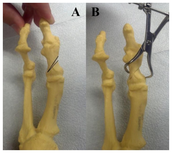 Figure 22