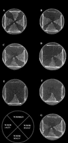 FIG.3.