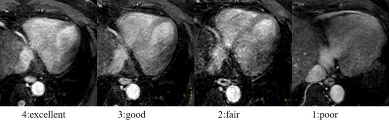 Fig. 4