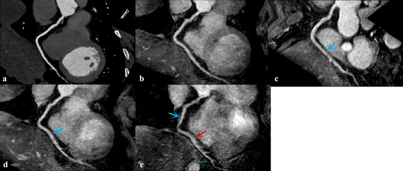 Fig. 9