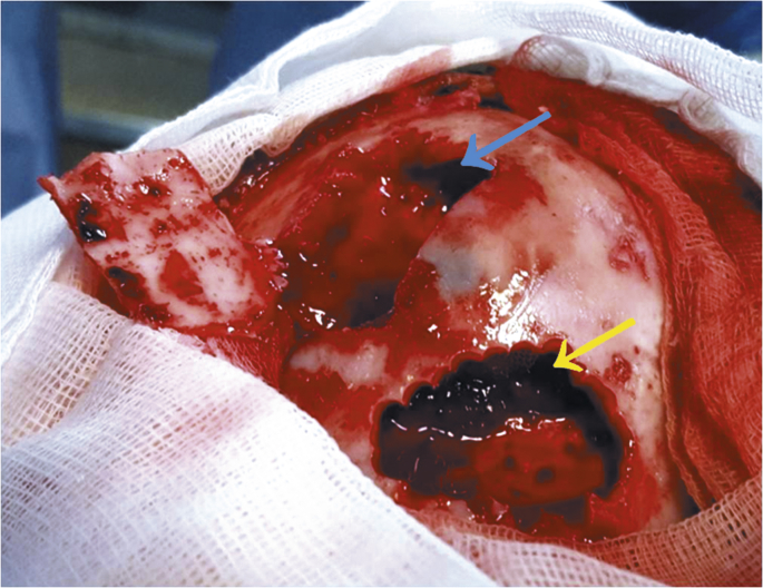 Fig. 2