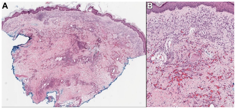 Fig 2