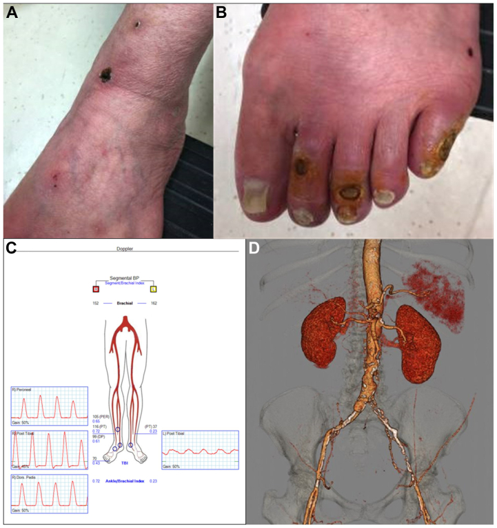 Fig 3