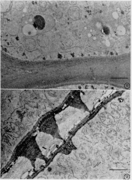 Fig. 12,13