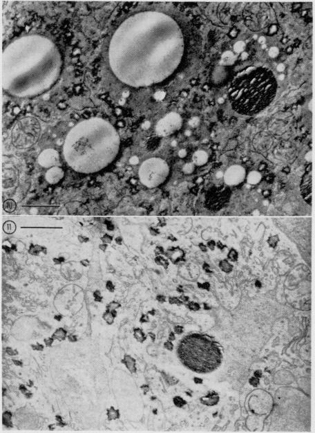 Fig. 10,11