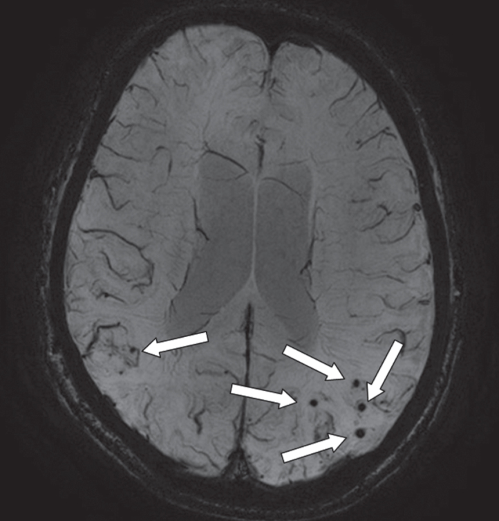 Fig.4