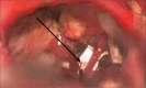 Figure 3: