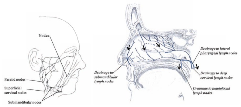 Fig. (13)