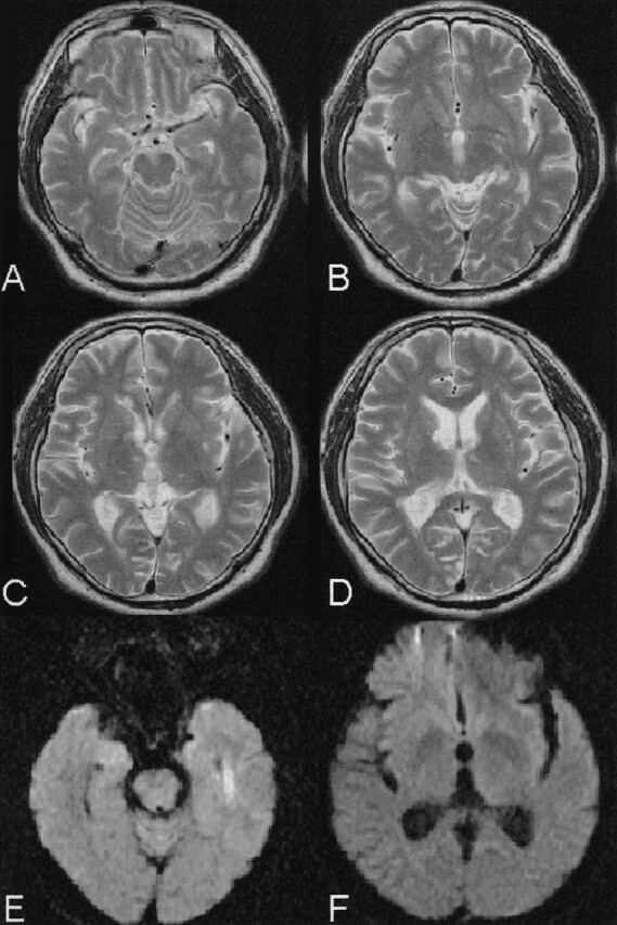 Fig 3.