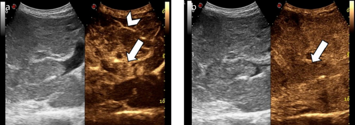 Figure 4. a, b