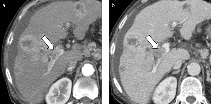 Figure 2. a, b