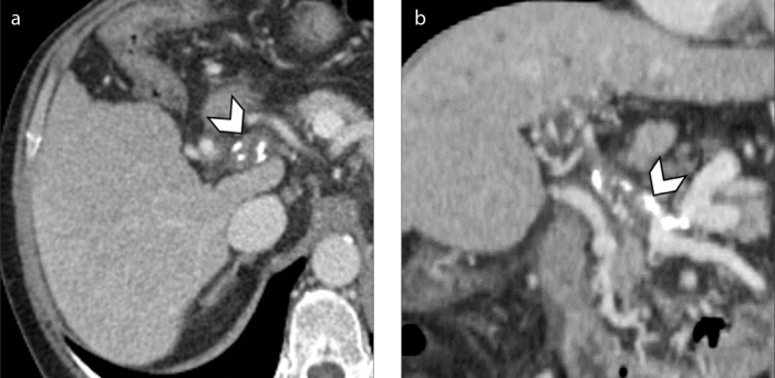 Figure 6. a, b